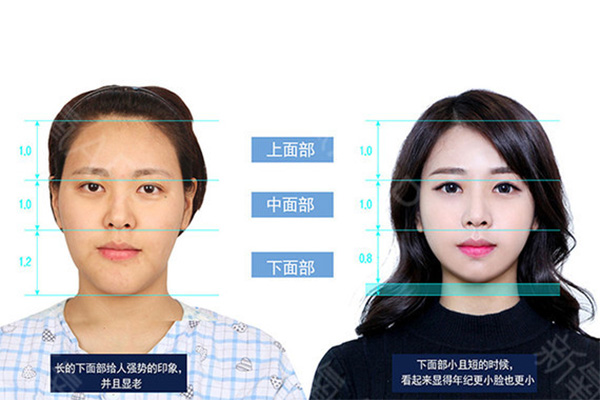 韩国菲斯莱茵童颜黄金比例.jpg