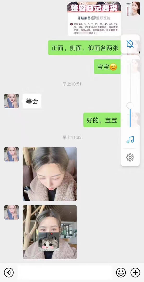 菲斯莱茵额头缩小术后恢复日记.jpg