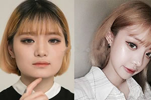 韩国菲斯莱茵下颌角缩小术案例.jpg