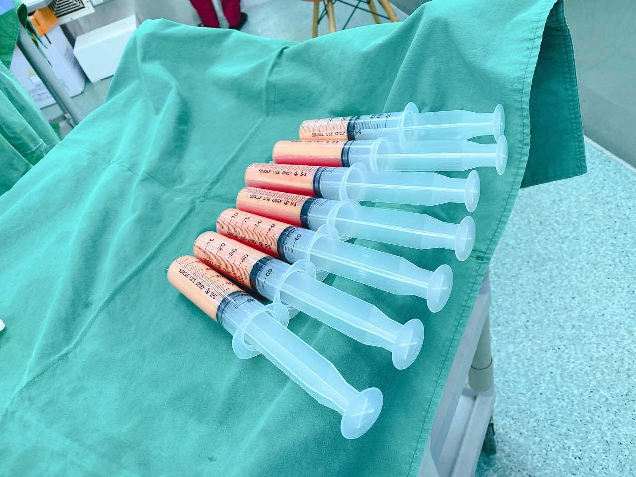兰斯吸脂针管