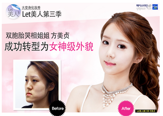 双鄂手术前后对比.png