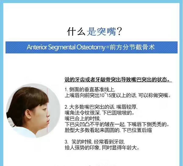 什么是凸嘴手术.jpg