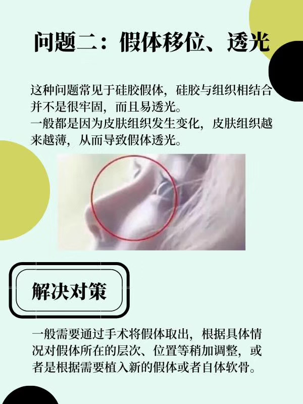 隆鼻术后出现假体移位透光怎么办.jpg