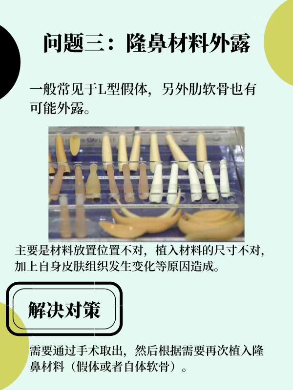 隆鼻后材料外露怎么办.jpg