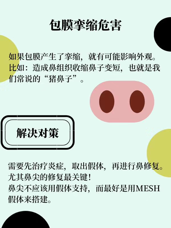 隆鼻手术包膜挛缩有哪些危害.jpg