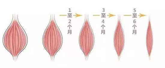 瘦脸针瘦脸的效果图.jpg