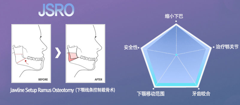 JSRO<span style=