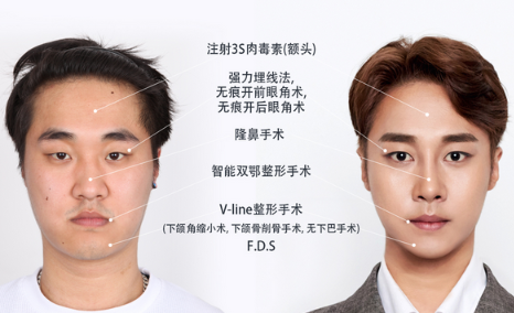 菲斯莱茵前后对比案例.png