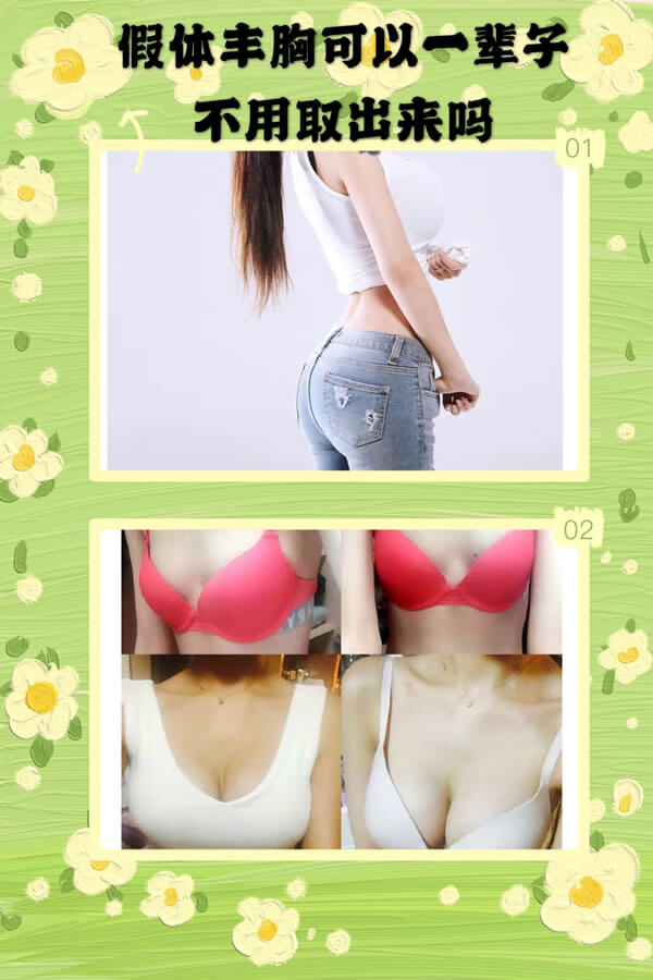 假体丰胸材料可以一辈子不用取吗.jpg