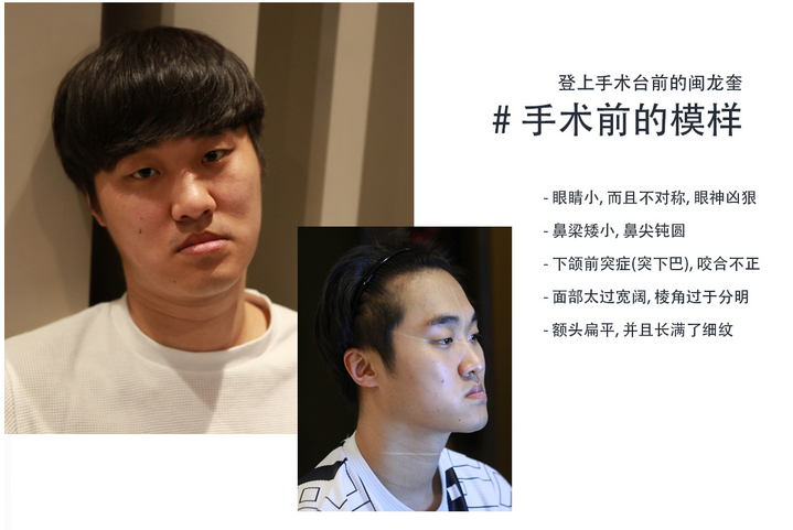 菲斯莱茵案例.png