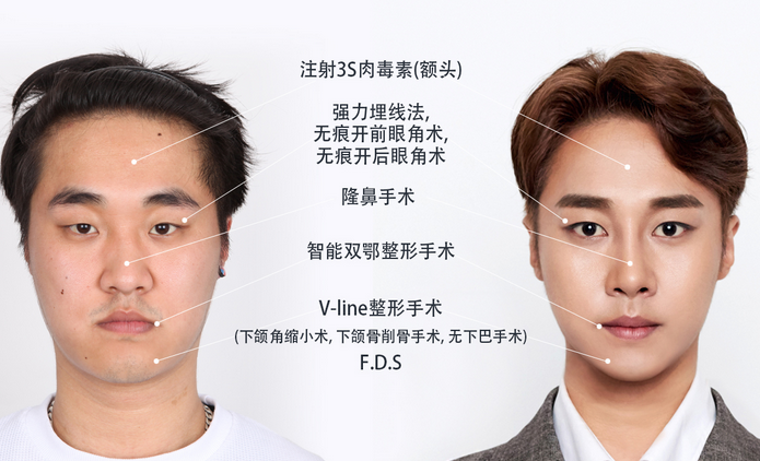 菲斯莱茵案例.png