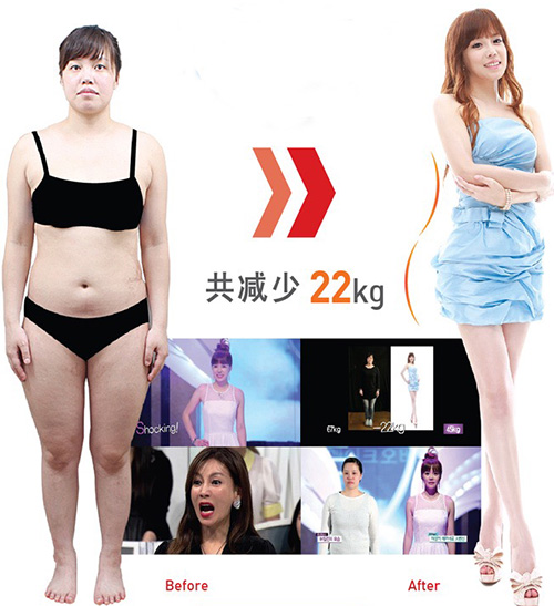 韩国365mc吸脂医院全身吸脂案例对比图