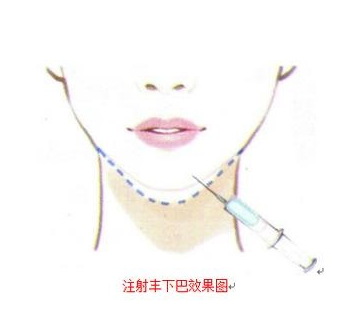 垫下巴.png