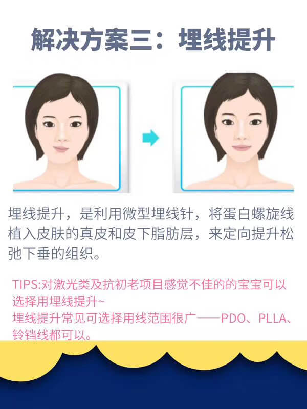 面部不对称解决方案埋线提升.jpg