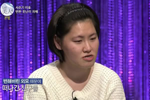 韩国菲斯莱茵JSRO双颚手术术前.jpg