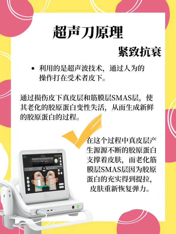 面部提升超声刀手术原理.jpg