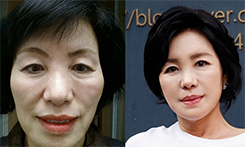 菲斯莱茵案例.png