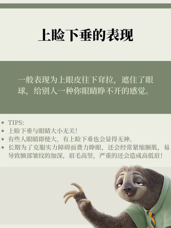 上睑下垂的表现.jpg