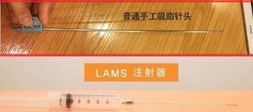 揭秘：为什么说LAMS（兰斯）吸脂是为夏天而生的吸脂术？