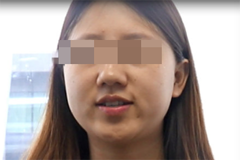 肉肉脸