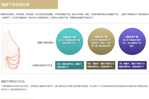 胸下垂自我诊断.jpg