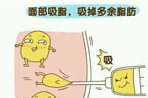 面部吸脂示意图