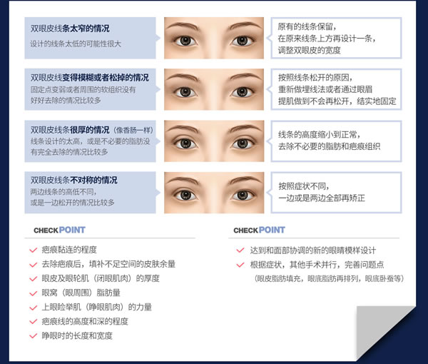 双眼皮修复手术情况.jpg