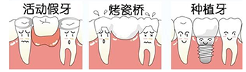 镶牙.png