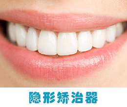 隐形矫治器佩戴效果图