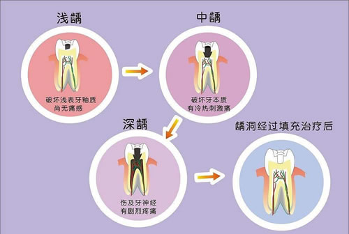 牙齿出现问题如何修补.jpg
