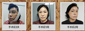 菲斯莱茵案例.png