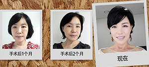 菲斯莱茵案例.png