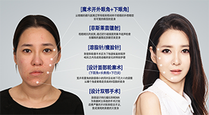 菲斯莱茵案例1.png