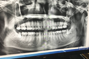 清远德艺口腔