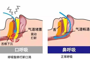 口呼吸和鼻呼吸对比