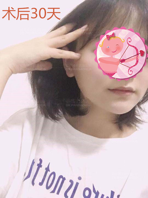 重庆华美潘宝华磨骨案例