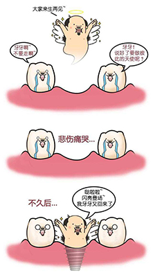 种植牙过程动画