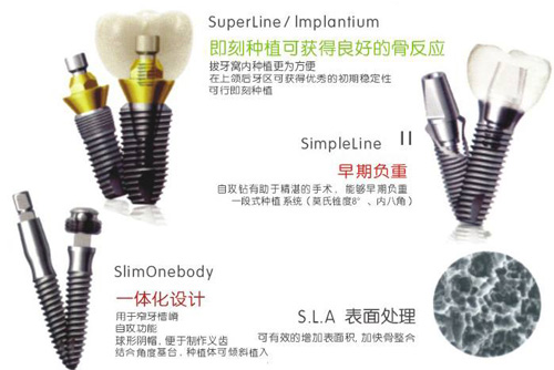 韩国登腾种植牙品牌特色优势